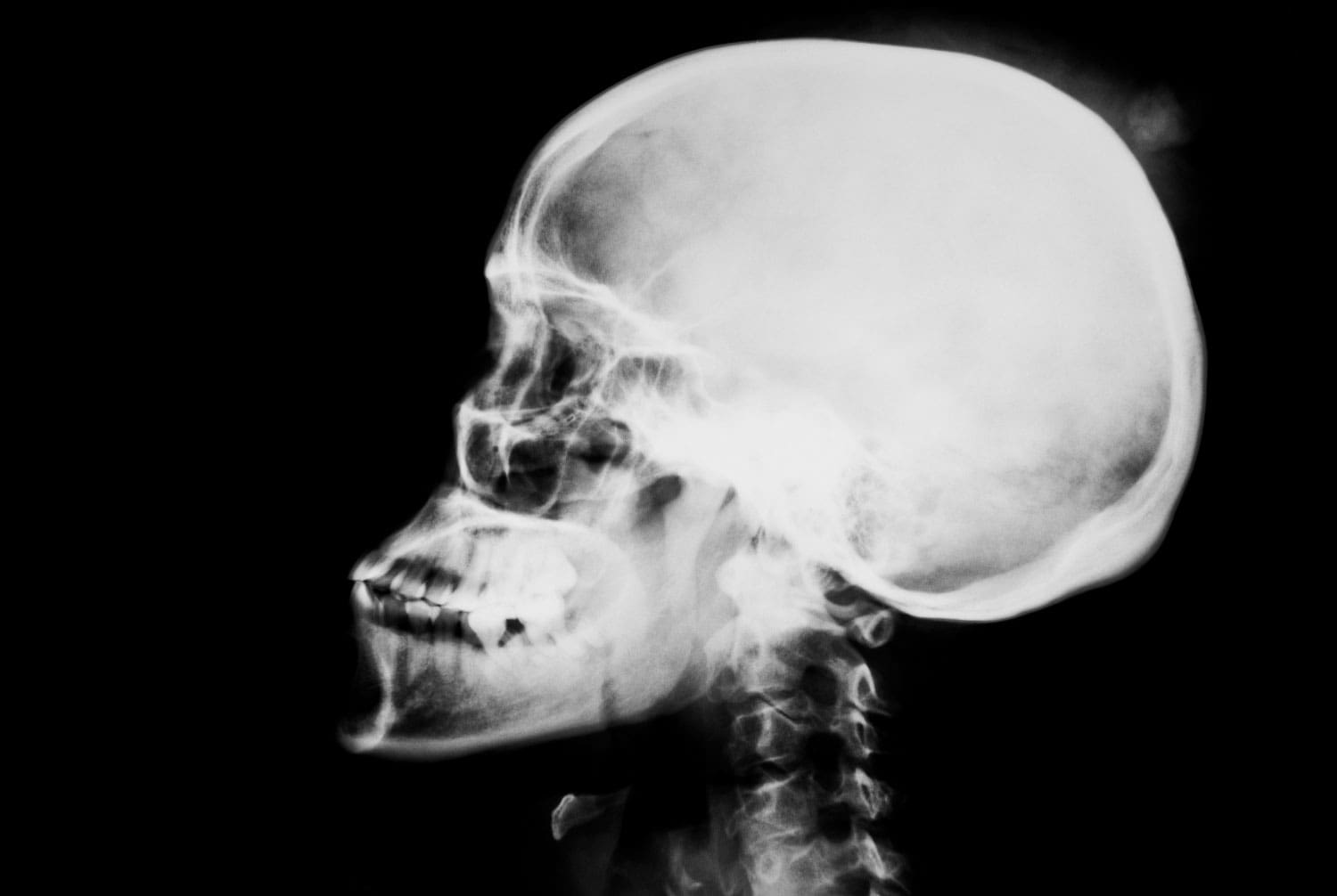 brain-injury-attorneys Personal injury and Accidental Lawyers at Ron Bell Albuquerque, New Mexico