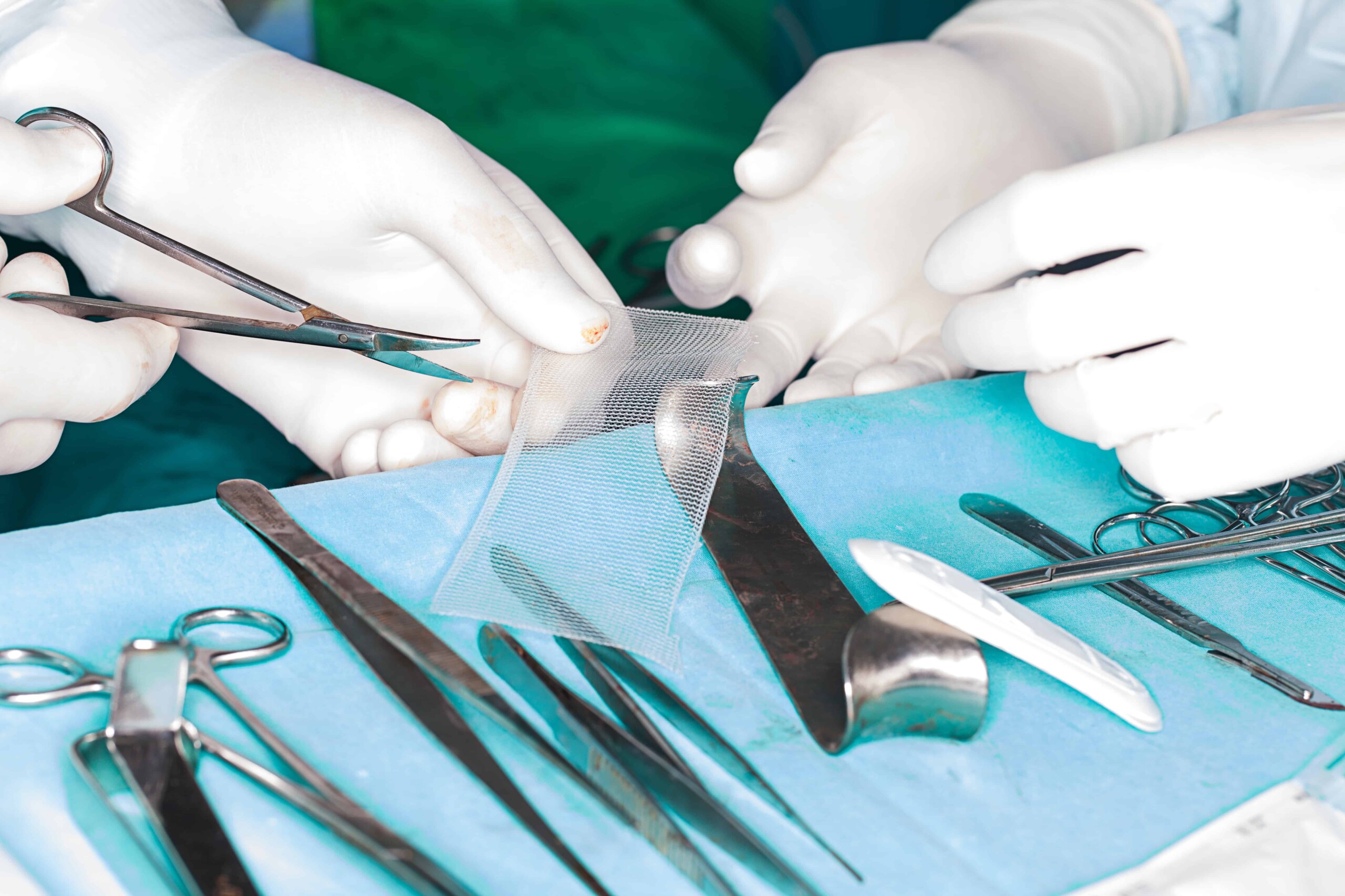 Huges & Coleman Hernia Mesh Attorneys Kentucky Hernia Mesh Attorneys
