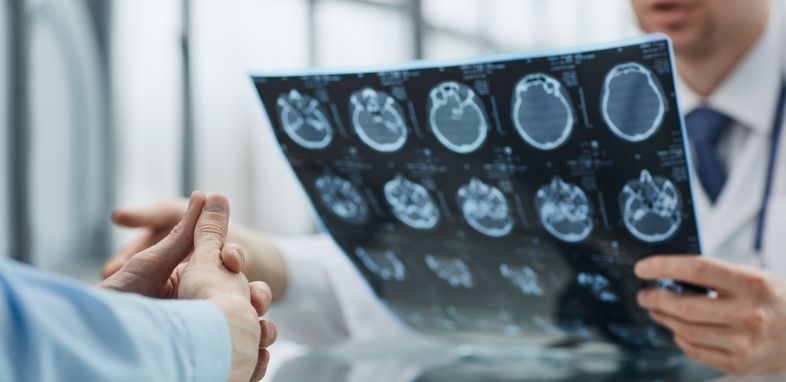 Brain Injury doctor examining brain scan results